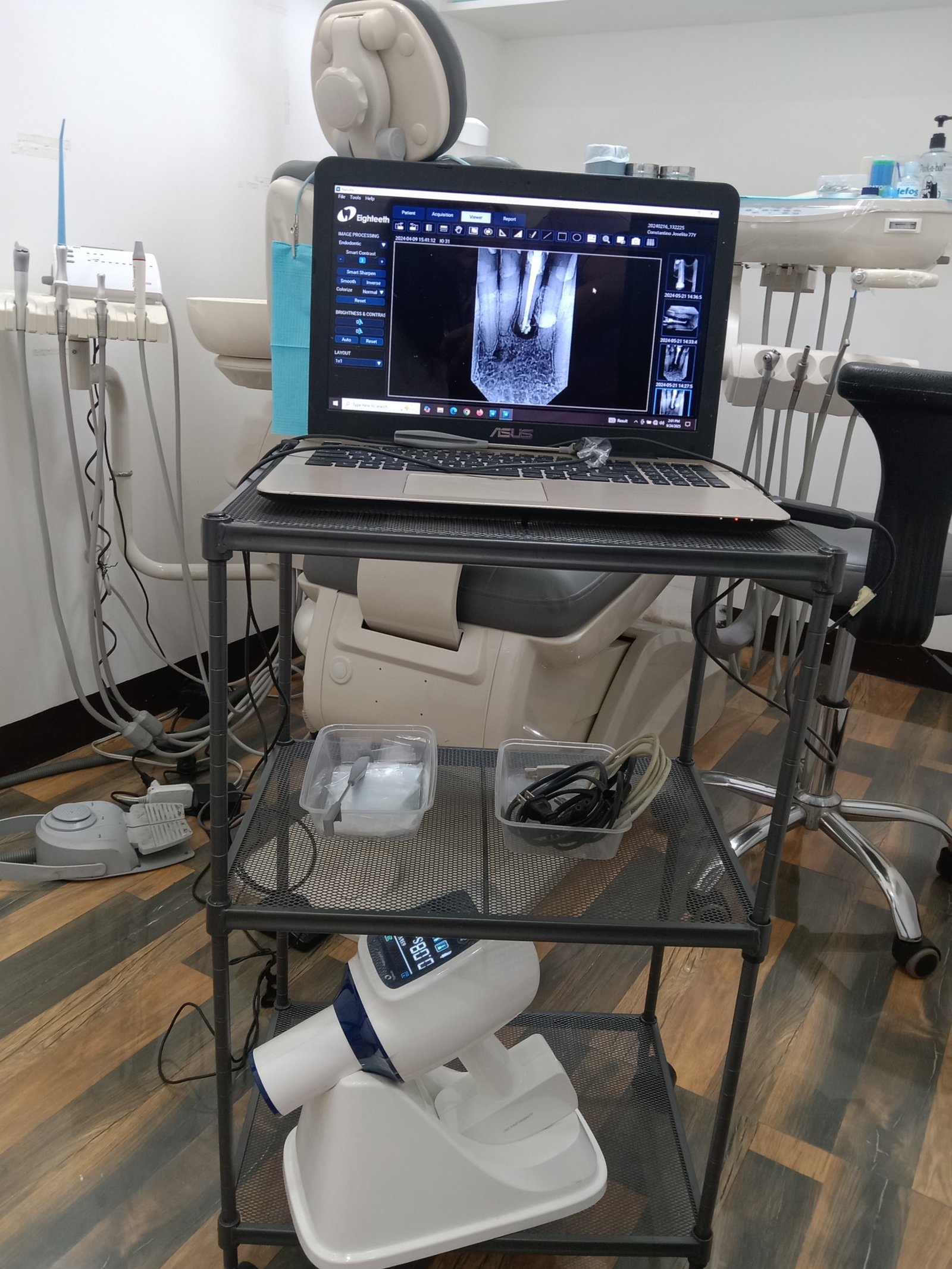 Digital X-Ray